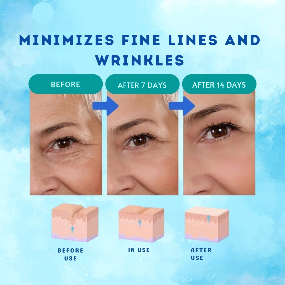 ボトックスセラム エリクサー アンチリフト インテンス 